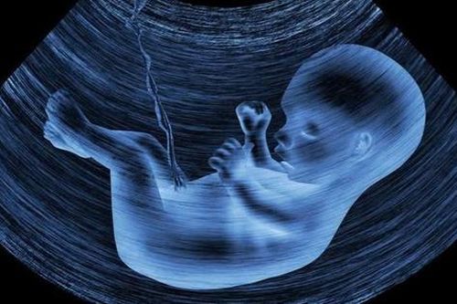 Al hỗ trợ bác sĩ siêu âm phát hiện dị tật thai nhi nhanh hơn
