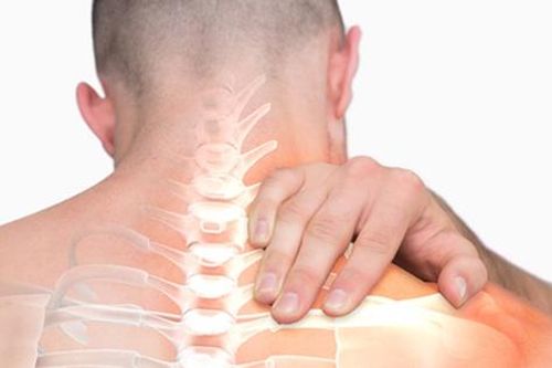 6 câu hỏi thường gặp về hội chứng đầu cổ