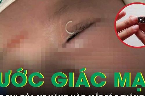 Bé 2 tháng tuổi trầy xước giác mạc vì mẹ bấm móng tay văng vào mắt