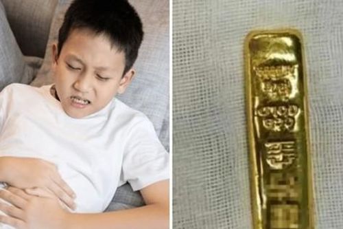 Bé trai ở Trung Quốc thấy bụng bị sưng, hóa ra bé đã nuốt một thỏi vàng lớn