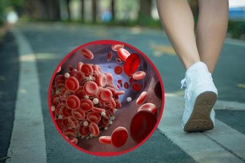 4 bất thường khi đi bộ cảnh báo cục máu đông đang 'xâm chiếm' cơ thể