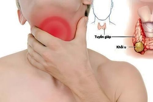 Người đàn ông 49 tuổi bất ngờ phát hiện bệnh tuyến giáp từ dấu hiệu nhiều người Việt bỏ qua