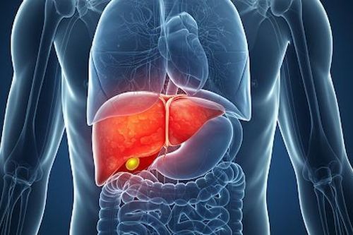 5 câu hỏi thường gặp về hội chứng Budd-Chiari