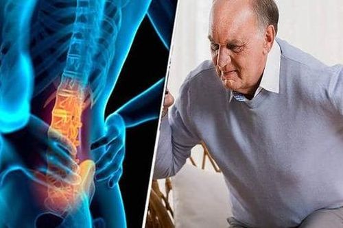 Hội chứng đuôi ngựa: Nguyên nhân, biểu hiện, cách điều trị và phòng bệnh