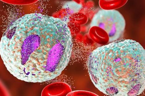 Leukemia kinh dòng bạch cầu hạt: Nguyên nhân, biểu hiện, cách điều trị và phòng bệnh