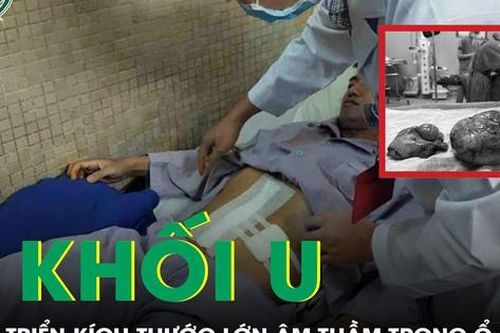 Bàng hoàng phát hiện 4 khối u trong bụng, tất cả đều có hoại tử trung tâm