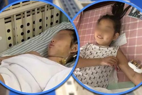 Rơi từ tầng 25 xuống tầng 7, bé gái sống sót kỳ diệu