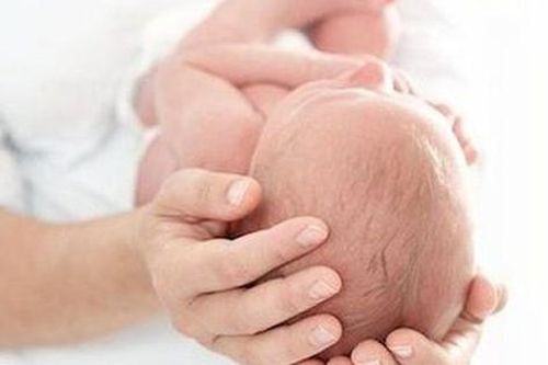 Câu hỏi thường gặp liên quan đến hội chứng Crouzon