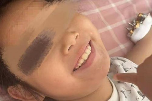 Bé gái sống sót kỳ diệu sau khi rơi từ tầng 25 tại Trung Quốc