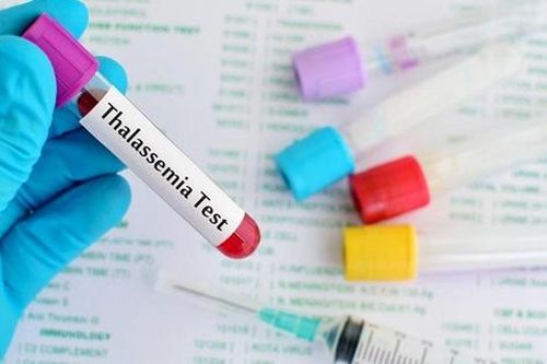 Cần làm gì để phát hiện gen tan máu bẩm sinh?