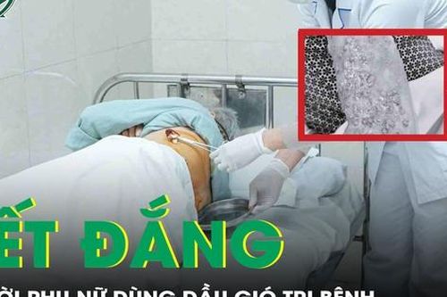 Người phụ nữ nhận kết đắng vì dùng dầu gió để trị bệnh zona thần kinh