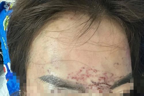 Một phụ nữ ở Cà Mau tố cáo bị bắt cóc, hành hạ dã man