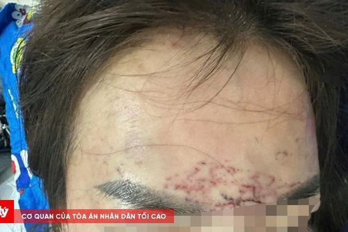 Công an vào cuộc làm rõ vụ người phụ nữ bị hành hung ở Cà Mau