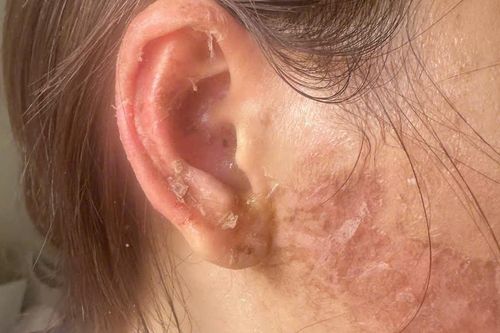 Điều tra vụ người phụ nữ ở Cà Mau tố bị đánh đập, cắt tóc