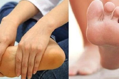 Điều trị kịp thời ca bệnh di truyền hiếm gặp sau nhiều năm bị chẩn đoán nhầm