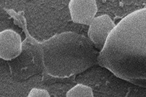 Phát hiện loài virus khổng lồ, lớn gấp 2 lần virus cúm