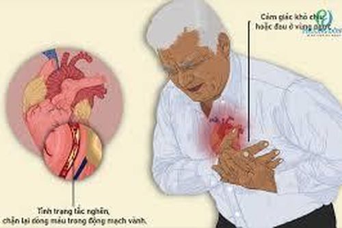 Cơn đau thắt ngực không ổn định có nguy hiểm không?