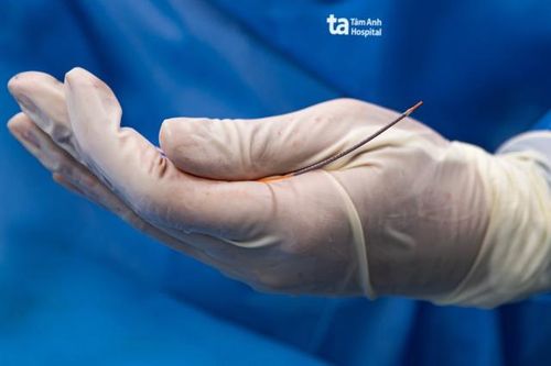 Stent phủ thuốc thế hệ mới giúp kéo dài tuổi thọ cho bệnh nhân tim mạch