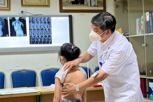 Bệnh viện Hữu nghị Việt Đức khám, tư vấn miễn phí bệnh lý gù vẹo cột sống ở trẻ em