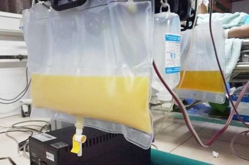 Lý do khiến huyết tương người đàn ông đục như nước gạo