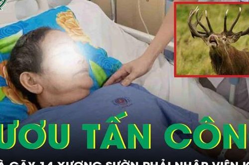 Cụ bà 72 tuổi gãy 14 xương sườn phải nhập viện cấp cứu vì bị hươu tấn công