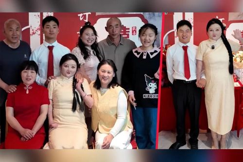 Duyên phận kỳ lạ của cô gái bỏng 95% cơ thể với người chồng sinh cùng ngày