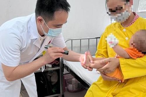 Trẻ mắc tay chân miệng có những biểu hiệu này, cha mẹ cần đưa ngay đến bệnh viện