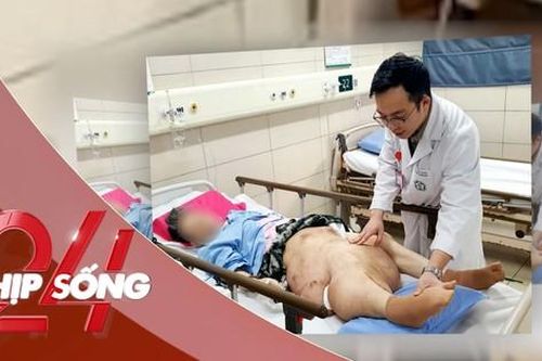 NHỊP SỐNG 24: Bỏ không điều trị khối u, người phụ nữ liệt hoàn toàn, biến dạng nhiều bộ phận cơ thể