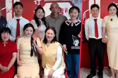 Cô gái bị bỏng 95% cơ thể lấy chàng trai sinh cùng ngày, tháng, năm