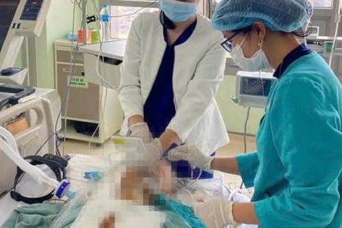 Cụ ông nhập viện do bị hóc thịt bò khi ăn cỗ