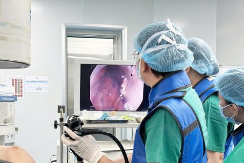 Bệnh viện 22-12 thực hiện nội soi can thiệp lấy đoạn xương cá đâm xuyên thành dạ dày cho bệnh nhân
