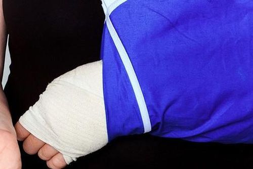 Câu hỏi thường gặp liên quan đến hội chứng Sudeck