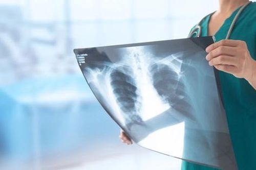 Hậu quả kép từ thuốc lá thế hệ mới: Gây nghiện, ngộ độc và dễ gây hiểu lầm về sức khỏe