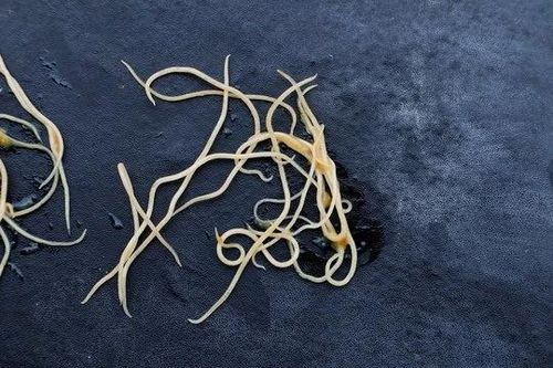 Vì sao tẩy nhiều lần vẫn không hết giun kim?
