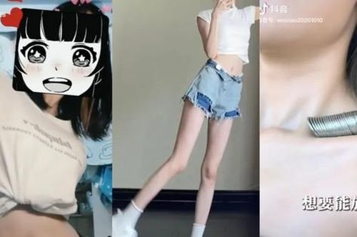 Bên trong cơn sốt phẫu thuật thẩm mỹ ở Trung Quốc