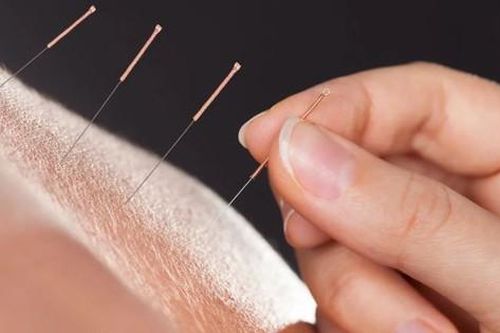 Người đàn ông 47 tuổi phải cắt một bên chân sau khi đi châm cứu