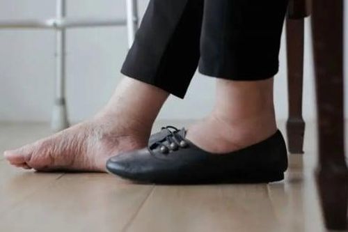 5 bất thường ở tay chân cảnh báo tắc nghẽn mạch máu