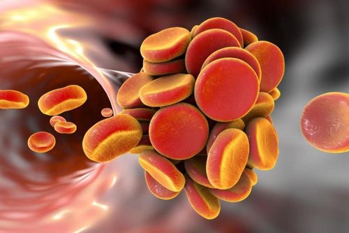 Những thực phẩm giúp đánh tan cục máu đông hiệu quả