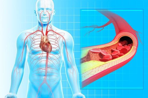 Mạch máu càng trẻ, càng sống lâu: Bác sĩ chỉ cách kiểm tra và làm sạch mạch máu