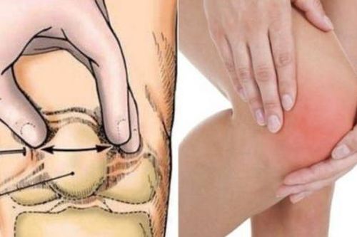 Viêm tủy xương: Nguyên nhân, triệu chứng, cách điều trị và phòng ngừa