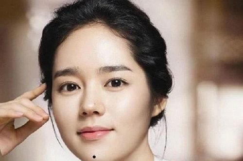 5 nốt ruồi quý hơn vàng, dù là nam hay nữ đều phát tài