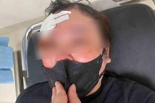 Công an vào cuộc vụ người phụ nữ tố bị tài xế ô tô dùng dùi cui vụt vào đầu