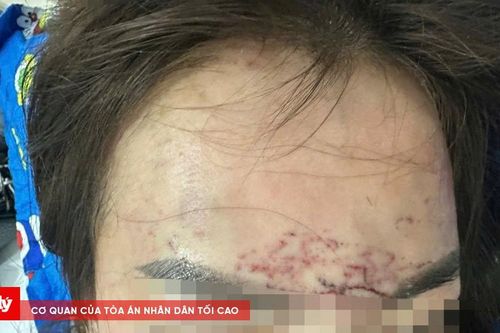 Khởi tố vụ án người phụ nữ bị hành hung ở Cà Mau