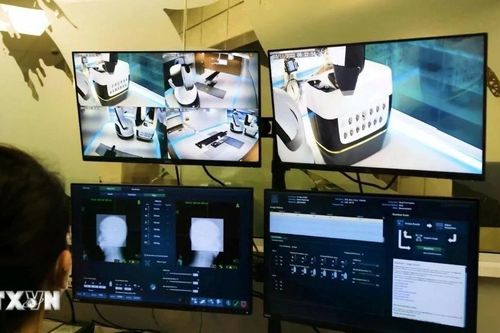 Bệnh viện đầu tiên ở Việt Nam có hệ thống robot xạ phẫu tích hợp AI chữa ung thư