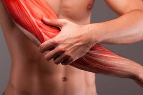 Viêm cơ, áp xe cơ: Nguyên nhân, triệu chứng, cách điều trị và phòng ngừa