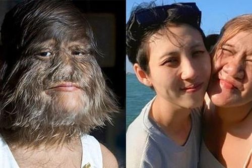 Cô gái 'nhiều lông nhất thế giới' tìm được tình mới sau đổ vỡ hôn nhân