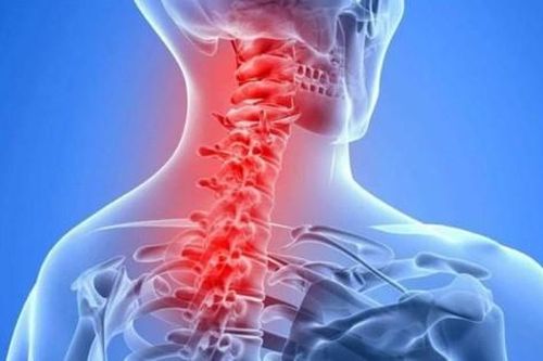 Đau cổ vai gáy có nguy hiểm, khi nào là bệnh lý phải nhập viện?