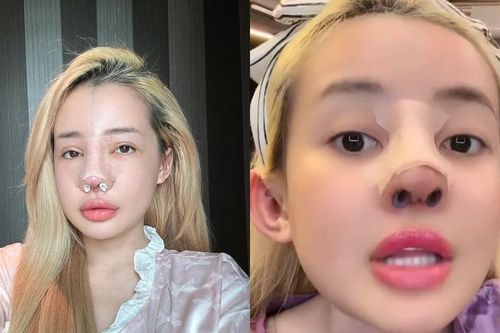 'Nghiện' phẫu thuật thẩm mỹ, Ngân 98 lại chuẩn bị 'đập đi xây lại'