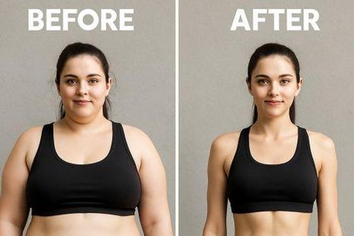 Tiêm thuốc giảm cân: Có thể mang lại cả vóc dáng lẫn tinh thần phấn chấn?