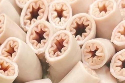Chuyên gia: Con lợn nào có nhiều giun sán thì khả năng có lòng se điếu